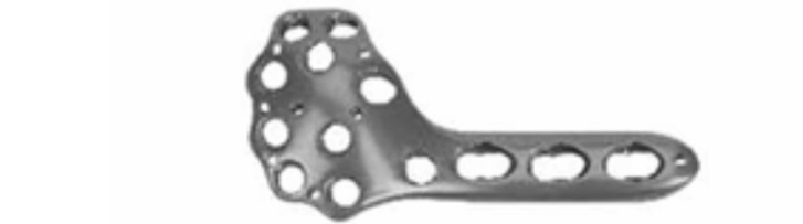 Дистальна латеральна мищелкова стегнова блокуюча пластина UMP